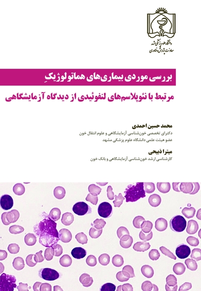بررسی موردی بیماریهای هماتولوژیک مرتبط با نئوپلاسمهای لنفوئیدی از دیدگاه آزمایشگاهی
